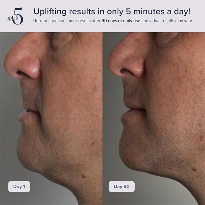 upLift 5 Pulsating Facial Lift | 5 Minute Age Reversal Device, Contours & - Image 4