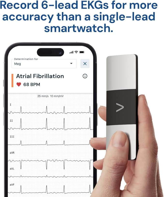 AliveCor KardiaMobile 6-Lead Personal EKG Monitor – Six Views of The Heart – - Image 4